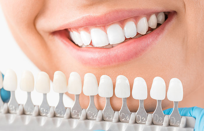 インプラント手術