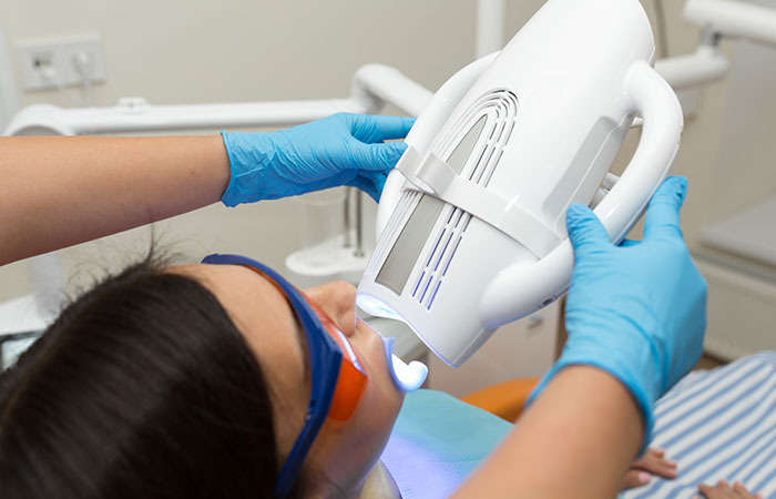 オフィスホワイトニング