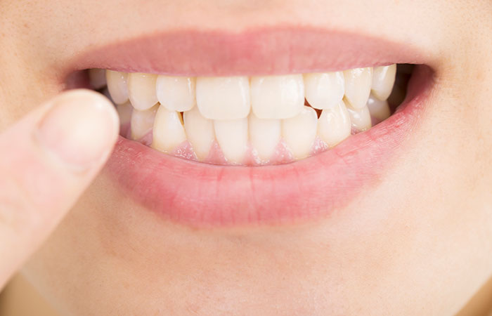 デュアルホワイトニング